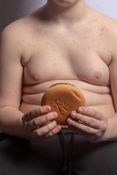 Adolescente Caucasiano Com Excesso Peso Comendo Hambúrguer — Fotografia de Stock