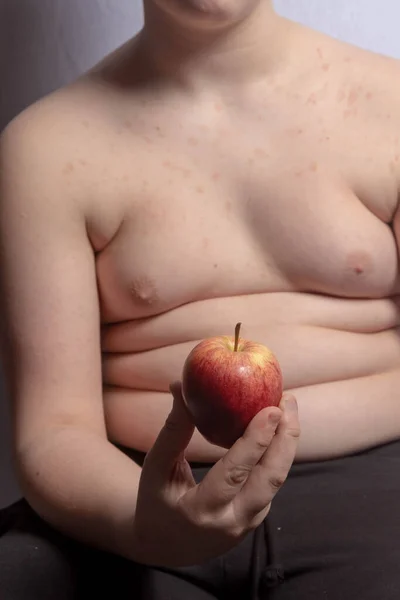 Een Overgewicht Blanke Tiener Jongen Met Een Appel — Stockfoto