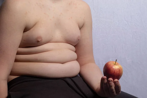 Adolescente Caucásico Con Sobrepeso Sosteniendo Una Manzana —  Fotos de Stock