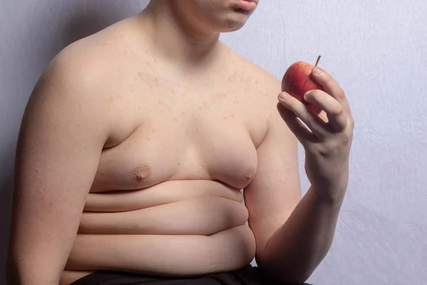 Een Overgewicht Blanke Tiener Jongen Met Een Appel — Stockfoto