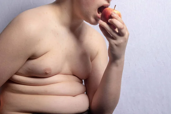 Adolescente Caucasiano Com Sobrepeso Comendo Anapple — Fotografia de Stock