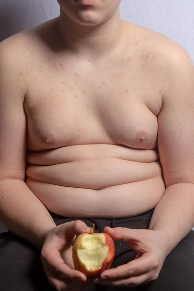 太りすぎCaucasian十代の男の子保持AアップルとともにAビート取り上げ — ストック写真