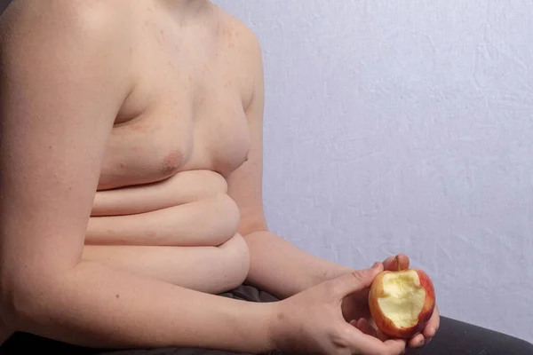 Ένας Υπέρβαρος Καυκάσιος Έφηβος Που Κρατάει Ένα Μήλο Μια Δαγκωνιά — Φωτογραφία Αρχείου