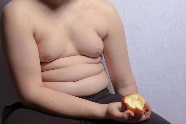 Een Blanke Tienerjongen Met Overgewicht Die Een Appel Vasthoudt Met — Stockfoto