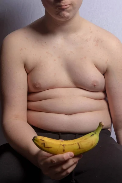 Een Overgewicht Blanke Tiener Jongen Met Een Bananna — Stockfoto