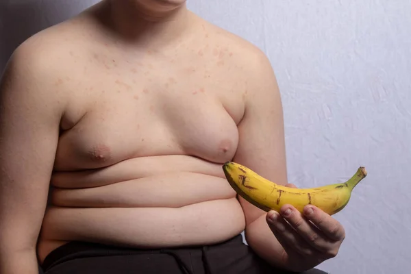 Een Overgewicht Blanke Tiener Jongen Met Een Bananna — Stockfoto