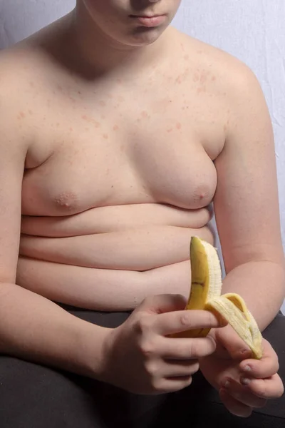 太りすぎCaucasian十代の男の子持っていますA皮をむいたバナナ — ストック写真