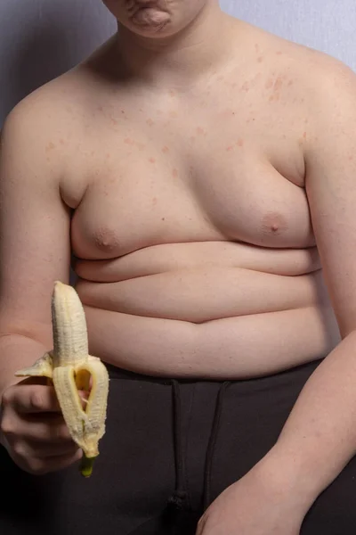 Adolescente Caucasiano Com Excesso Peso Segurando Uma Bananna Descascada — Fotografia de Stock