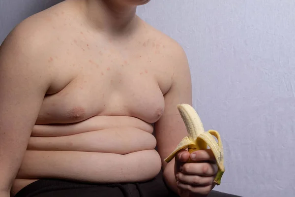 Ragazzo Adolescente Caucasico Sovrappeso Con Una Banana Pelata — Foto Stock