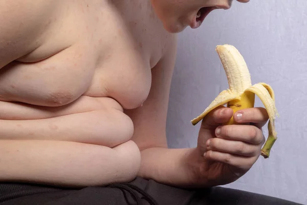 Adolescente Caucásico Con Sobrepeso Punto Comerse Plátano — Foto de Stock