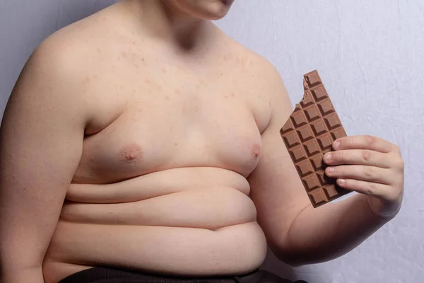 Adolescente Caucasiano Com Excesso Peso Segurando Uma Barra Chocolate Com — Fotografia de Stock