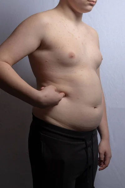 Adolescente Caucásico Con Sobrepeso Mostrando Estómago Mientras Está Pie — Foto de Stock