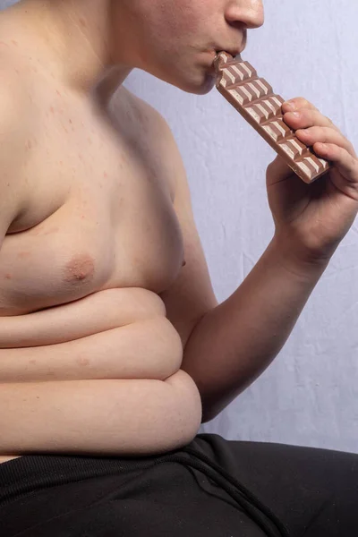 Ένας Υπέρβαρος Καυκάσιος Έφηβος Που Τρώει Σοκολάτα Γάλακτος — Φωτογραφία Αρχείου