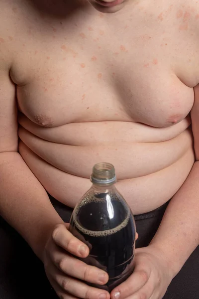 Een Blanke Tiener Met Overgewicht Die Een Fles Cola Vasthoudt — Stockfoto