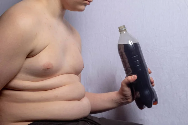 Een Blanke Tiener Met Overgewicht Die Een Fles Cola Vasthoudt — Stockfoto
