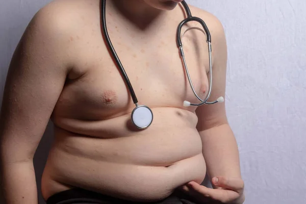 Een Blanke Tiener Met Overgewicht Die Zijn Maag Vasthoudt Met — Stockfoto