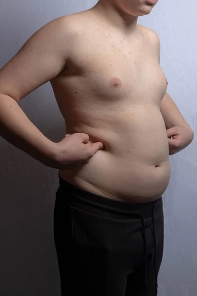 立っている間に彼の胃を示す太りすぎの白人の十代の男の子 — ストック写真