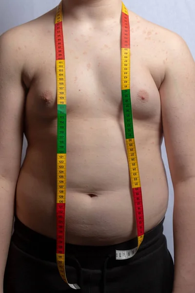 Overweight Caucasian Teenage Boy Tape Measure His Neck — Stock Photo, Image