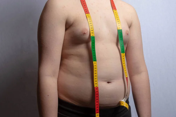 Een Overgewicht Blanke Tiener Jongen Met Een Meetlint Rond Zijn — Stockfoto