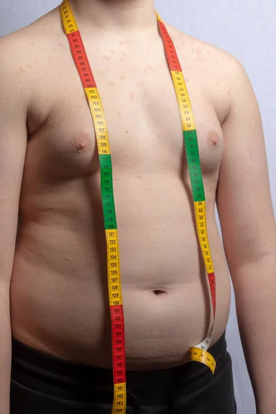 Nadváha Kavkazský Dospívající Chlapec Páskou Opatření Kolem Krku — Stock fotografie