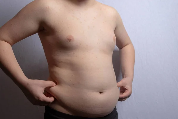 Nadwaga Biały Nastolatek Pokazuje Swój Żołądek Podczas Stania — Zdjęcie stockowe