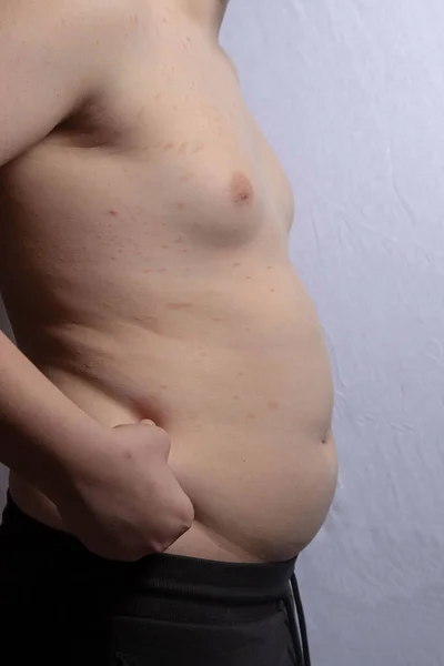 Nadwaga Biały Nastolatek Pokazuje Swój Żołądek Podczas Stania — Zdjęcie stockowe