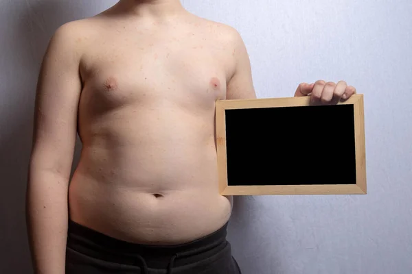 一个超重的高加索少年拿着一块空白黑板 — 图库照片