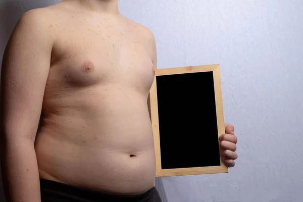 Een Blanke Tiener Met Overgewicht Die Een Leeg Schoolbord Vasthoudt — Stockfoto