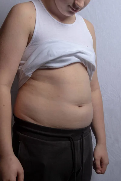 Adolescente Caucásico Sin Camisa Con Sobrepeso Que Lleva Top Sin — Foto de Stock