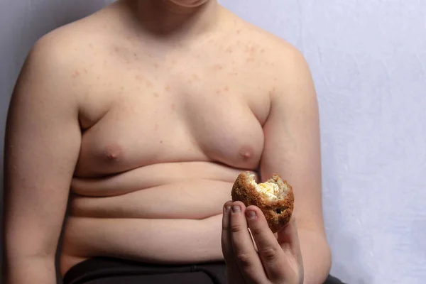 Ένας Υπέρβαρος Καυκάσιος Έφηβος Τρώει Ένα Αυγό Ουίσκι — Φωτογραφία Αρχείου