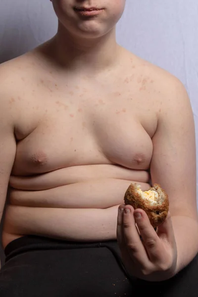 Adolescente Caucásico Con Sobrepeso Comiendo Huevo Escocés — Foto de Stock