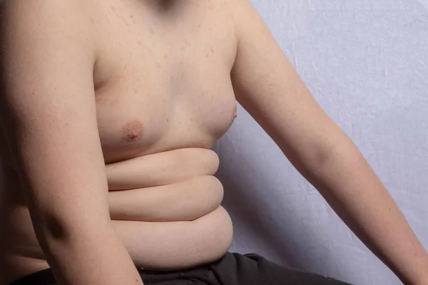 Een Overgewicht Shirtloze Blanke Tiener Jongen Zitten — Stockfoto
