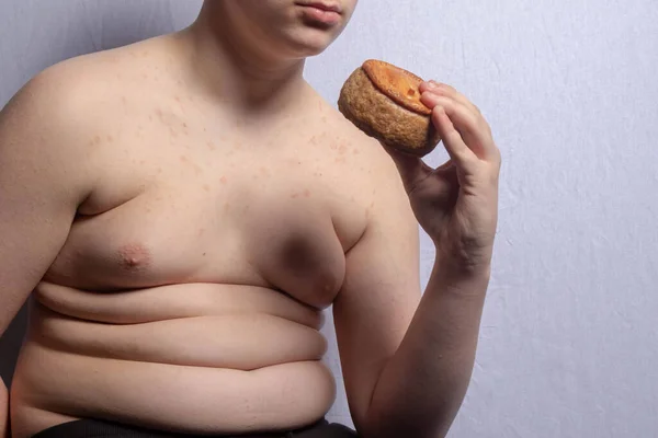 Adolescente Caucasiano Com Excesso Peso Segurando Uma Torta Porco — Fotografia de Stock