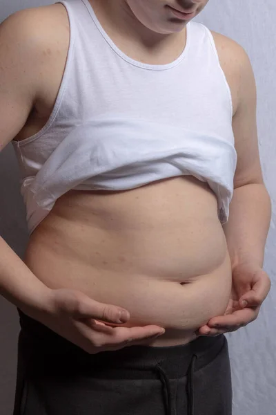 Een Overgewicht Shirtloze Blanke Tiener Jongen Draagt Een Mouwloze Top — Stockfoto