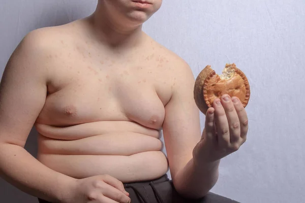 Ένας Υπέρβαρος Καυκάσιος Έφηβος Τρώει Μια Κρεατόπιτα — Φωτογραφία Αρχείου