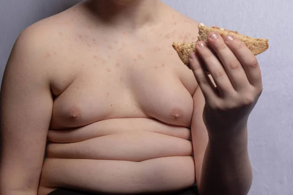 Надмірна Вага Білий Підліток Їсть Бутерброд — стокове фото