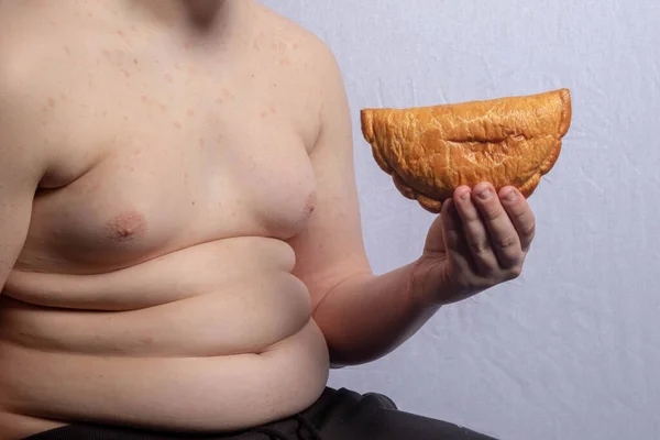 一个体重超标的高加索少年男孩 手里拿着一块玉米片 — 图库照片