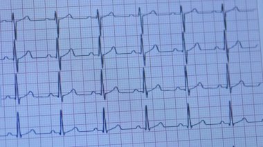 Düzenli kalp ritmi gösteren basılı elektrokardiyogramın yakın görüntüsü. Kardiyoloji teşhisi için tıbbi veri tablosu ve kalp sağlığı izleme.