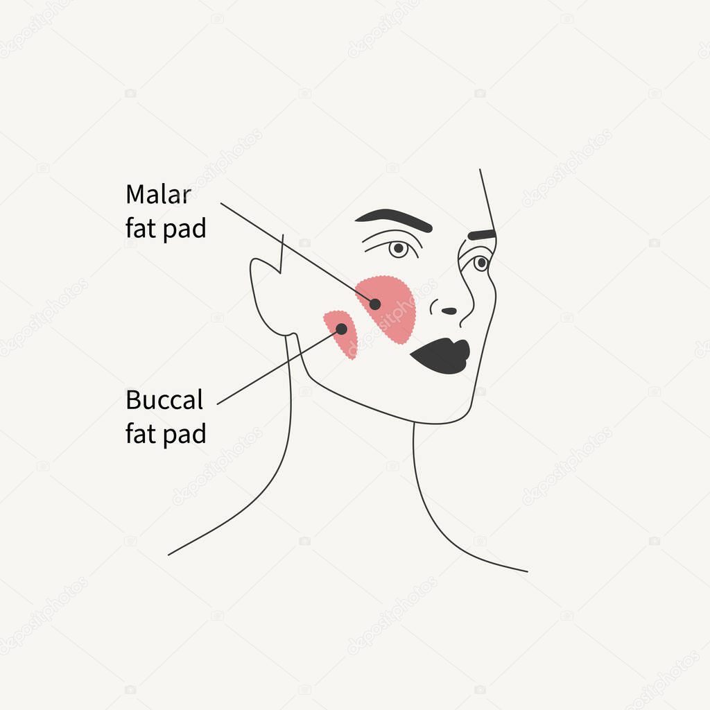 Removal of malar fat pad and buccal fat pad. Antiaging facelift with plastic surgery. Plastic surgery illustration