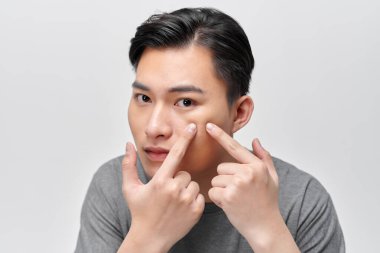 Yüzünde sivilce arayan genç adamın yakın plan fotoğrafı.