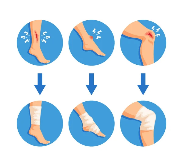 Leg Bandaging Professional Wraps Patients Leg Specialized Bandage Support Healing — Stock Vector
