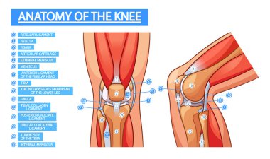 Anatomy Of Knee Joint Medical Infographic Poster. Patella, Femur, Articular Cartilage. External or Internal Meniscus, Tibia, Patellar, Tibial, Collagen Ligament. Anterior Ligament of the Fibular Head clipart