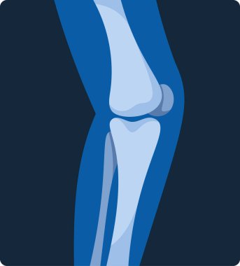 İnsan diz iskeleti x-ray taraması