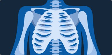 İnsan kaburga röntgeni.