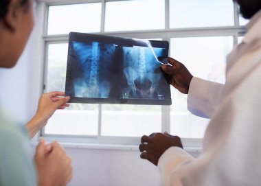 Karın röntgenini kapatın. Tıbbi tedaviyi gözden geçiren iki doktor tarafından tutuluyor. Yüksek kalite fotoğraf