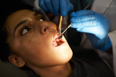 Yüksek çözünürlüklü bir görüntü diş muayenesini yakalıyor, eldivenli bir dişçinin eldiven takarak ameliyat yaptığını gösteriyor, kaliteli diş bakımı ve hastanın dikkatini vurguluyor..