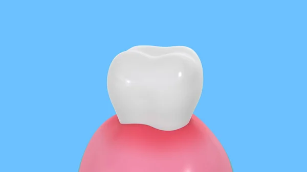 Gesundheit Und Schönheit Konzeption Blase Der Zahnpasta Reinigung Schmutzigen Zahnfleisches — Stockfoto