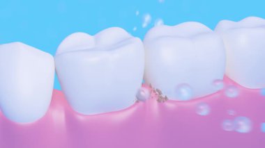 Sağlık kavramı. Açık mavi arka planda dişlere yapışan temiz lekeler ve bakteriler için bir sürü baloncuk düşüyor. Diş macunu reklamları için video. 3 Boyutlu Hazırlama