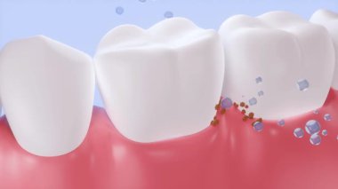 Sağlık kavramı. Açık mavi arka planda dişlere yapışan temiz lekeler ve bakteriler için bir sürü baloncuk düşüyor. Diş macunu reklamları için video. 3 Boyutlu Hazırlama