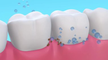 Sağlık kavramı. Açık mavi arka planda dişlere yapışan temiz lekeler ve bakteriler için bir sürü baloncuk düşüyor. Diş macunu reklamları için video. 3 Boyutlu Hazırlama